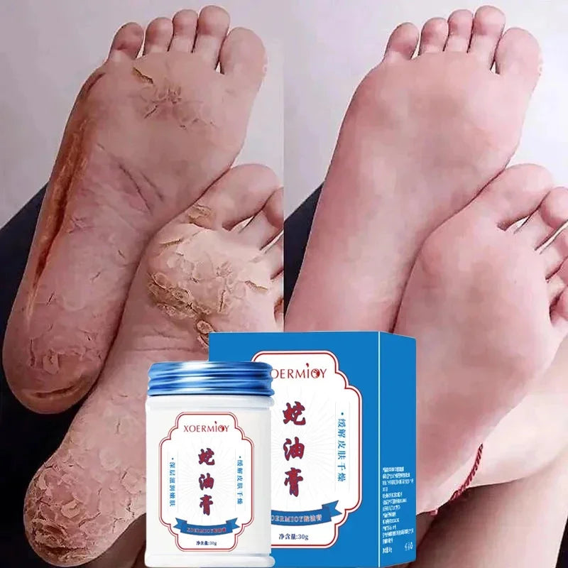 Anti Crack Foot Cream