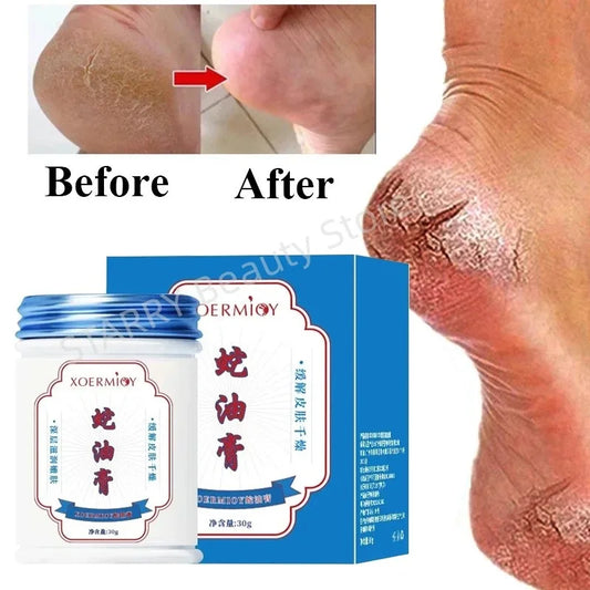 Anti Crack Foot Cream