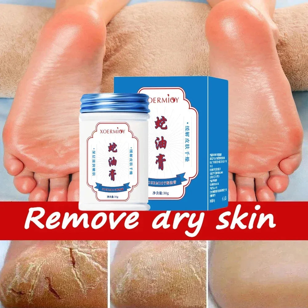 Anti Crack Foot Cream